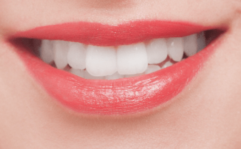 歯科の自費診療を上手に勧める方法と回収方法